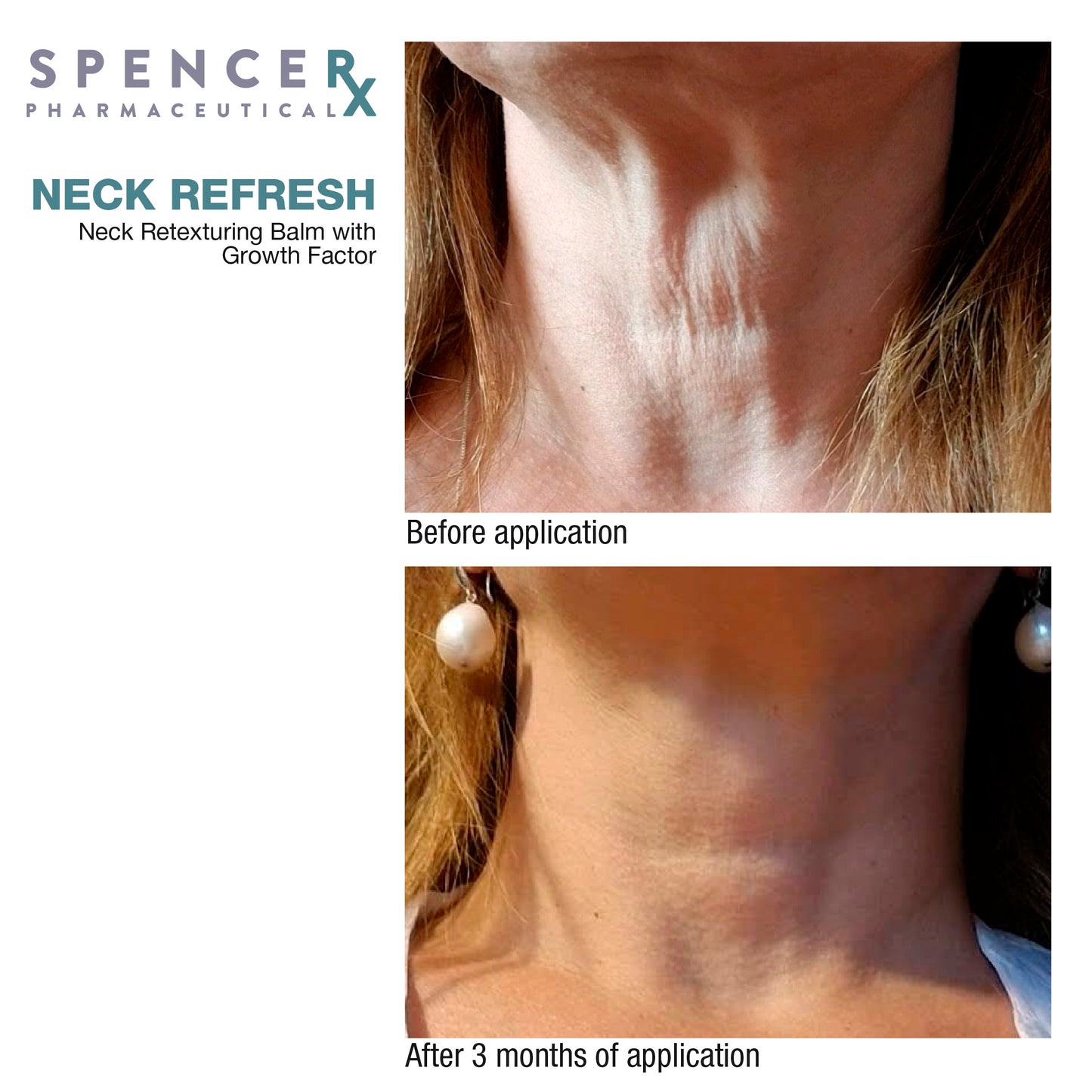 SpenceRX Neck Refresh