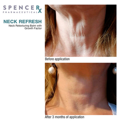 SpenceRX Neck Refresh